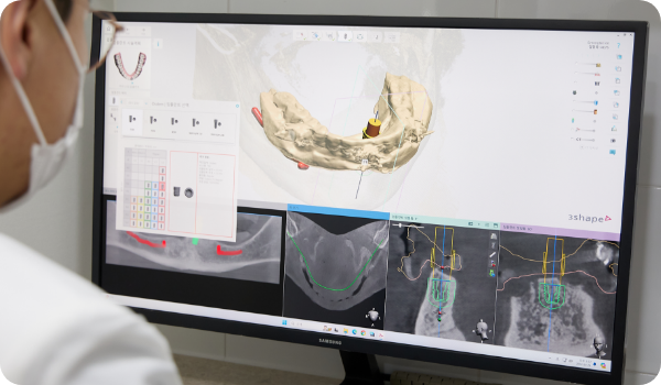 치과의사가  직접 설계 하는 임플란트 모의 수술