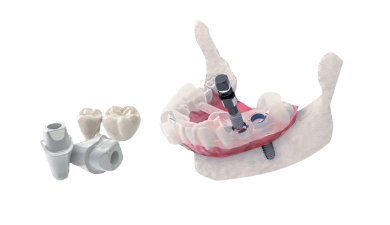 연세탁월한치과를 선택한 환자분들을 위해, 그리고 세밀한 조정 하나하나까지 놓치지 않기 위해 3shape사의 임플란트 스튜디오를 사용하여 직접 플래닝 합니다.